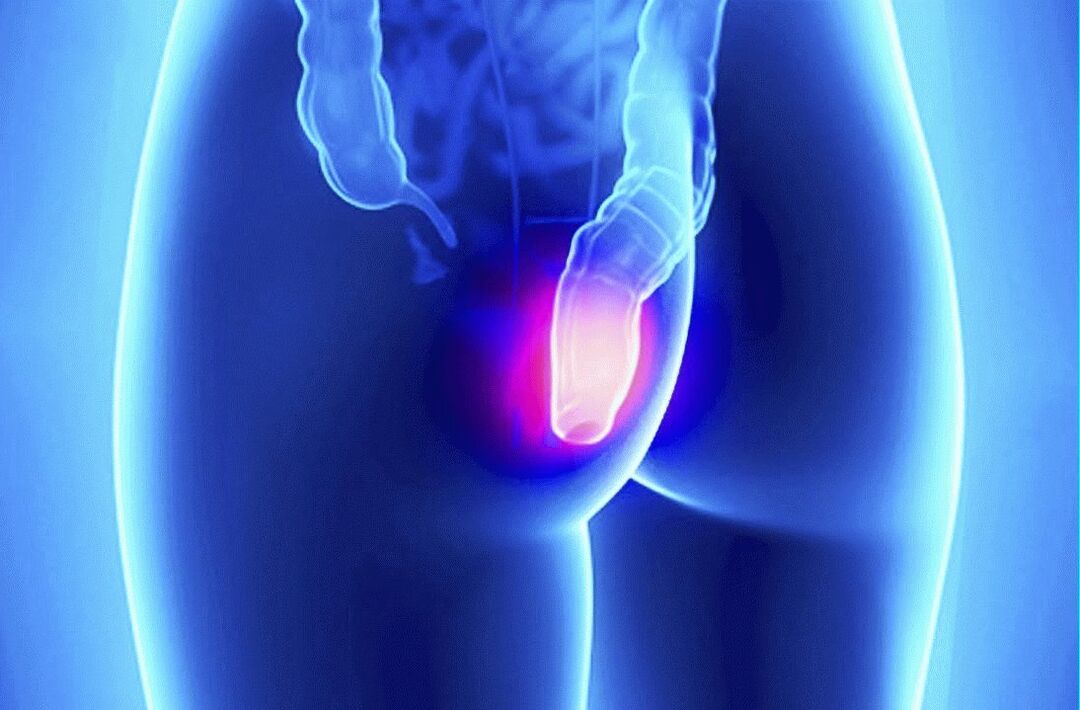 Gelarex galima naudoti tiek išoriškai, tiek rektališkai